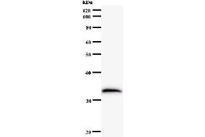 Western Blotting (WB) image for anti-MOB Kinase Activator 2 (MOB2) antibody (ABIN931152)
