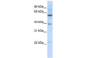SLC35F3 antibody used at 1 ug/ml to detect target protein. (SLC35F3 抗体  (Middle Region))
