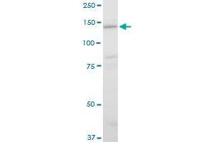 LAMC2 polyclonal antibody (A01), Lot # 051003JC01. (LAMC2 抗体  (AA 1084-1193))