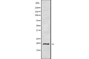 Western blot analysis of CD164L2 using HepG2 whole cell lysates (CD164L2 抗体)
