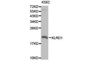 Western Blotting (WB) image for anti-Killer Cell Lectin-Like Receptor Subfamily D, Member 1 (KLRD1) antibody (ABIN1873452) (CD94 抗体)