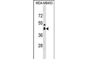 ALX1 Antibody (Center) (ABIN1538707 and ABIN2849356) western blot analysis in MDA-M cell line lysates (35 μg/lane). (ALX1 抗体  (AA 97-122))