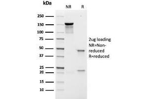 SDS-PAGE Analysis Purified Prolactin Receptor Recombinant Mouse Monoclonal (rPRLR742). (Recombinant Prolactin Receptor 抗体)