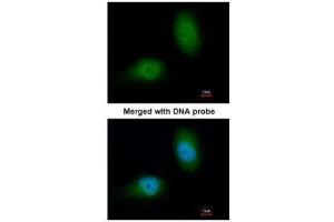 ICC/IF Image Immunofluorescence analysis of paraformaldehyde-fixed HeLa, using HSPB8, antibody at 1:200 dilution. (HSPB8 抗体  (C-Term))