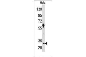 Image no. 1 for anti-Proto-Oncogene Pim-2 (Serine Threonine Kinase) (PIM2) (C-Term) antibody (ABIN360329)