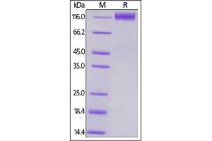 SDS-PAGE (SDS) image for CD96 (CD96) (AA 22-503) (Active) protein (Fc Tag) (ABIN6253540)