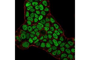 Flow Cytometric Analysis of PFA-fixed MCF-7 cells using MSH6 Mouse Monoclonal Antibody (MSH6/3086) followed by goat anti-Mouse IgG-CF488 (Blue); Isotype Control (Red). (MSH6 抗体  (AA 374-540))