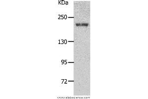 Western blot analysis of Mouse kidney tissue, using NPHS1 Polyclonal Antibody at dilution of 1:700 (Nephrin 抗体)
