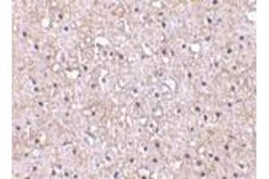 Immunohistochemistry (Paraffin-embedded Sections) (IHC (p)) image for anti-C1q and Tumor Necrosis Factor Related Protein 5 (C1QTNF5) (N-Term) antibody (ABIN499673)