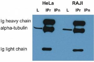Immunoprecipitation of alpha-tubulin from HeLa and RAJI cell lysate by antibody TU-16 and its detection by antibody TU-01 . (alpha Tubulin 抗体)