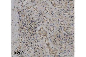 Immunohistochemical staining of IL-37 in human rheumatoid arthritis tissue. (IL-37 抗体)