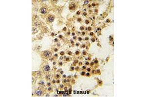 Formalin-fixed and paraffin-embedded human testis tissue reacted with GDF3 polyclonal antibody  , which was peroxidase-conjugated to the secondary antibody, followed by DAB staining. (GDF3 抗体  (Internal Region))