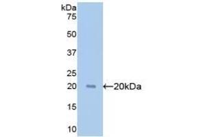 Detection of Recombinant GPC1, Human using Polyclonal Antibody to Glypican 1 (GPC1) (GPC1 抗体  (AA 114-277))