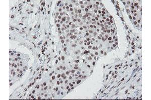 Image no. 15 for anti-TP53RK Binding Protein (TPRKB) antibody (ABIN1501484)