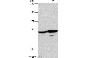 Western blot analysis of A431 and K562 cell, using GPR39 Polyclonal Antibody at dilution of 1:200 (GPR39 抗体)