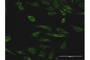 Immunofluorescence of purified MaxPab antibody to PRDX3 on HeLa cell.