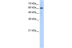 Western Blotting (WB) image for anti-ADAM Metallopeptidase Domain 30 (ADAM30) antibody (ABIN2463285) (ADAM30 抗体)