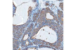 IHC analysis of SEC23IP using anti-SEC23IP antibody (ABIN7601222).