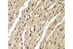 Immunohistochemistry of paraffin-embedded Human colon using PSMB8 Polyclonal Antibody at dilution of 1:100 (40x lens). (PSMB8 抗体)