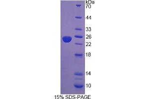 Image no. 1 for Protein Tyrosine Phosphatase Type IVA, Member 3 (PTP4A3) (AA 1-170) protein (His tag) (ABIN6237000) (PTP4A3 Protein (AA 1-170) (His tag))