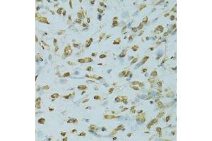 Immunohistochemistry (Paraffin-embedded Sections) (IHC (p)) image for anti-Scaffold Attachment Factor B (SAFB) (AA 1-200) antibody (ABIN6147357)