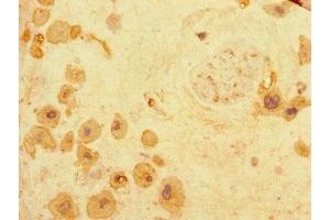Immunohistochemistry (IHC) image for anti-rho GDP Dissociation Inhibitor (GDI) gamma (ARHGDIG) (AA 1-225) antibody (ABIN7167911)