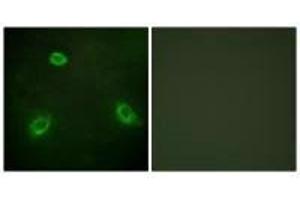 Immunofluorescence analysis of HepG2 cells, using TM16G antibody. (Anoctamin 7 抗体  (C-Term))