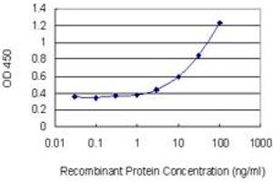Detection limit for recombinant GST tagged UAP1 is 1 ng/ml as a capture antibody. (UAP1 抗体  (AA 406-504))