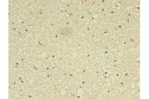 Immunohistochemistry (IHC) image for anti-ADAM Metallopeptidase with Thrombospondin Type 1 Motif, 7 (ADAMTS7) (AA 242-593) antibody (ABIN7142894)
