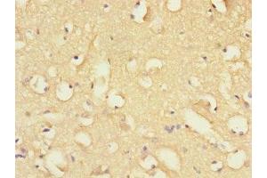 Immunohistochemistry of paraffin-embedded human brain tissue using ABIN7152410 at dilution of 1:100 (FBXO2 抗体  (AA 1-296))