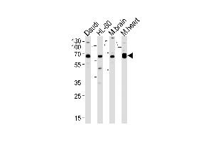 CSIN2 Antibody  (ABIN392666 and ABIN2842164) western blot analysis in Daudi,HL-60 cell line and mouse brain,rat heart lysates (35 μg/lane). (PACSIN2 抗体  (C-Term))