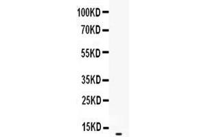 Western blot analysis of CXCL2 expression in recombinant human CXCL2 protein 0. (CXCL2 抗体  (AA 39-107))