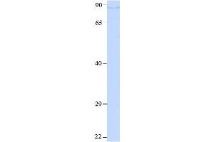 Host:  Rabbit  Target Name:  FURIN  Sample Type:  293T cell lysate  Antibody Dilution:  1. (FURIN 抗体  (N-Term))