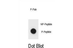 Dot blot analysis of IKKB Antibody (Phospho ) Phospho-specific Pab (ABIN1881450 and ABIN2850469) on nitrocellulose membrane. (IKBKB 抗体  (pSer177))