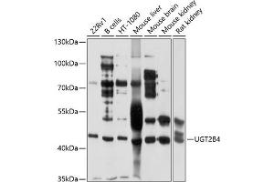 Western blot analysis of extracts of various cell lines, using UGT2B4 antibody (ABIN1683211, ABIN3018660, ABIN3018661 and ABIN6220530) at 1:1000 dilution. (UGT2B4 抗体  (AA 280-480))