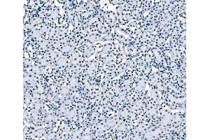 IHC analysis of splicing factor 1 using anti-splicing factor 1 antibody (ABIN7600193). (Splicing Factor 1 抗体  (AA 160-266))