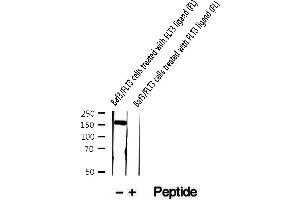 Western blot analysis of extracts of Baf3/FLT3 cells treated with FLT3 ligand (FL), using Phospho-FLT3 (Tyr969) Antibody .