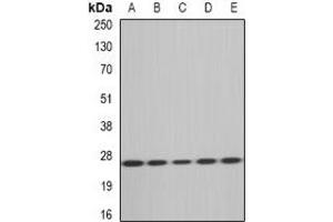 Western blot analysis of MsrA expression in HT29 (A), Hela (B), mouse heart (C), rat kidney (D), rat liver (E) whole cell lysates. (MSRA 抗体)
