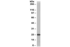 Western blot testing of HeLa lysate with TMS1 antibody at 1ug/ml. (PYCARD 抗体)