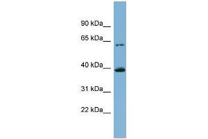 WB Suggested Anti-CYP3A4 Antibody Titration:  0. (CYP3A4 抗体  (Middle Region))