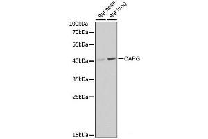 Western blot analysis of extracts of various cell lines using CAPG Polyclonal Antibody at dilution of 1:1000. (CAPG 抗体)