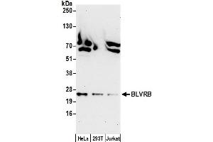 Western Blotting (WB) image for anti-Flavin Reductase (BLVRB) (AA 25-75) antibody (ABIN7450037)