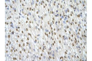 Rabbit Anti-ILF3 antibody   Paraffin Embedded Tissue: Human Heart cell Cellular Data: cardiac cell of renal tubule Antibody Concentration: 4. (Interleukin enhancer-binding factor 3 (ILF3) (N-Term) 抗体)