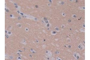 Immunohistochemistry (IHC) image for anti-Phosphatidylethanolamine Binding Protein 1 (PEBP1) (AA 2-187) antibody (ABIN7436330)