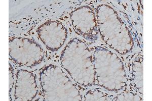 ABIN6267039 at 1/50 staining human colon tissue sections by IHC-P. (Histone 3 抗体)