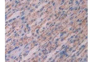 Detection of CTSD in Rat Stomach Tissue using Polyclonal Antibody to Cathepsin D (CTSD)