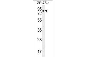 BTRC Antibody (N-term) (ABIN655814 and ABIN2845238) western blot analysis in ZR-75-1 cell line lysates (35 μg/lane). (BTRC 抗体  (N-Term))