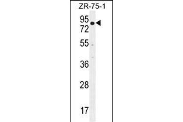 BTRC anticorps  (N-Term)