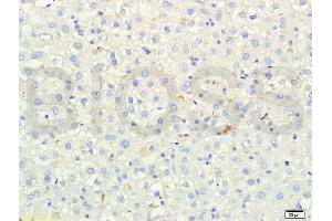Formalin-fixed and paraffin embedded rat liver tissue labeled with Anti-SREBP-2 Polyclonal Antibody, Unconjugated (ABIN751258) at 1:200 followed by conjugation to the secondary antibody and DAB staining (SREBF2 抗体)
