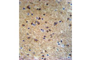 anti-ATPase, Cu++ Transporting, beta Polypeptide (ATP7B) (AA 1361-1391), (C-Term) antibody